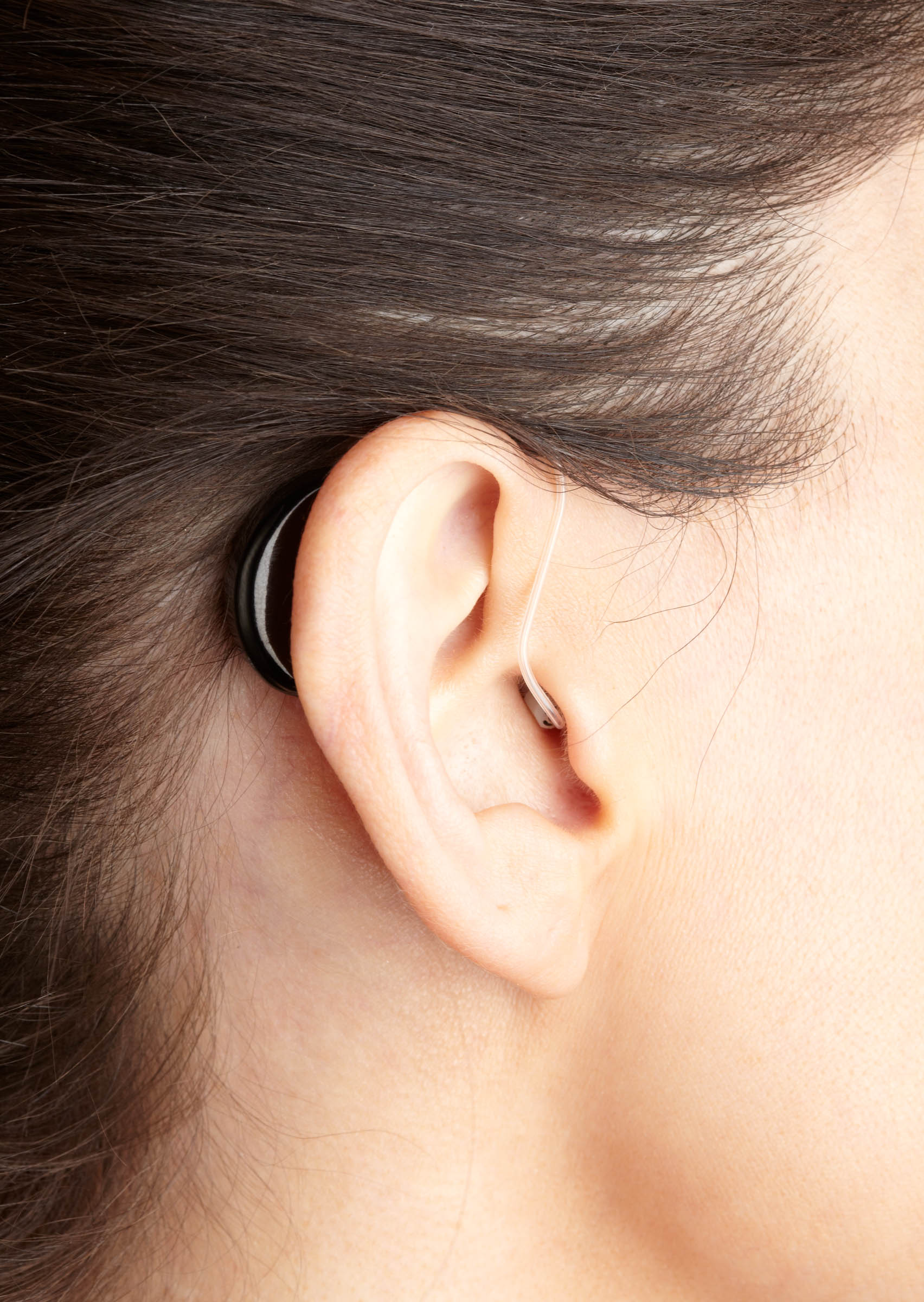 appareil-auditif-micro-contour-oreille-RIC